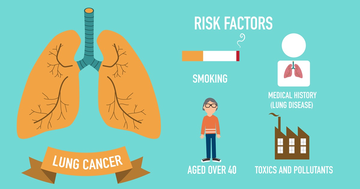Lung cancer and never-smokers