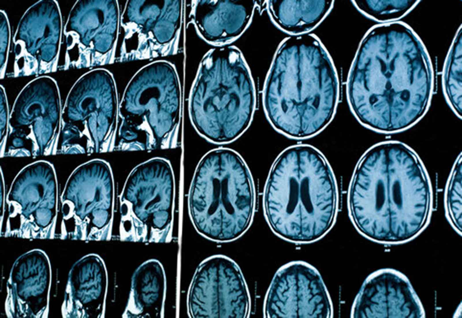 Dr Keith Wong Sleep Specialists Sydney, Sleep Apnea Specialist